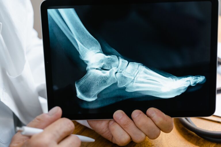 Best Orthopedic Doctor in Vijayawada: Your Complete Guide