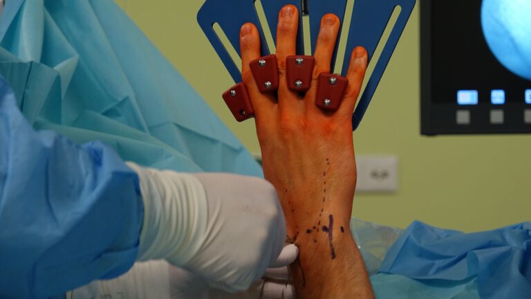 Orthopedic Surgeon in Guntur: A Guide to Choosing the Right Specialist